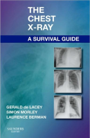 The Chest X-Ray - A Survival Guide.pdf
